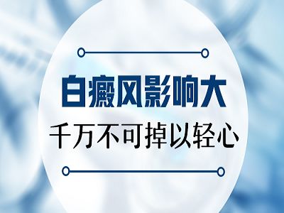 昆明手部白癜风会有什么危害